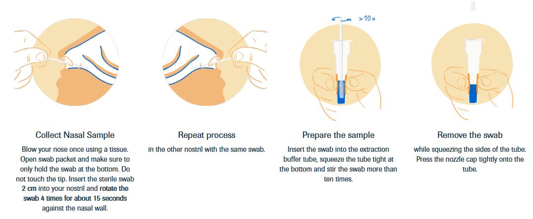 Buy Roche Sars Cov 2 Antigen Self Test Nasal Art 5 Test Kits Box Online At Best Price Lumiere32 Sg